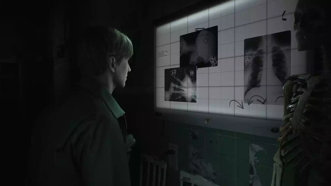 Silent Hill 2 Remake está em fase final de polimento
