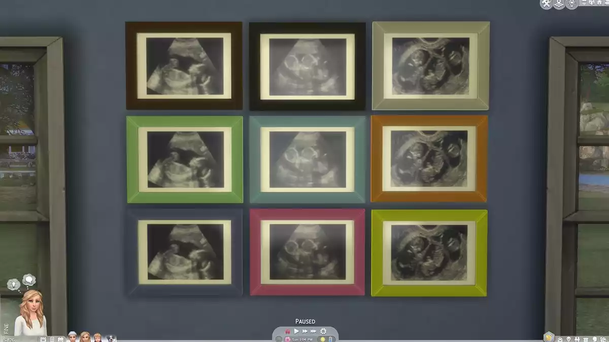 The Sims 4 Mod Ultrasound Scan